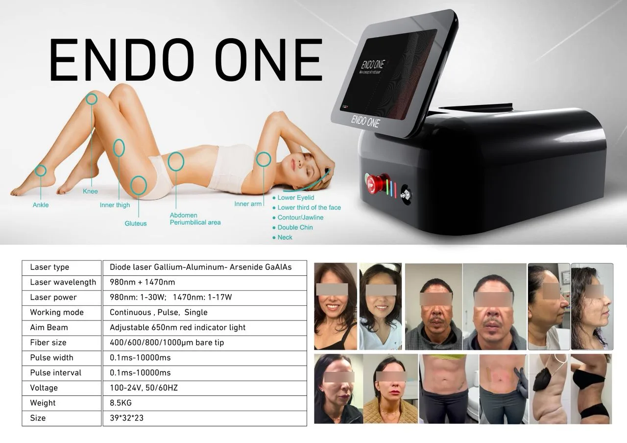 Endo-One Fiber Skin Tightening