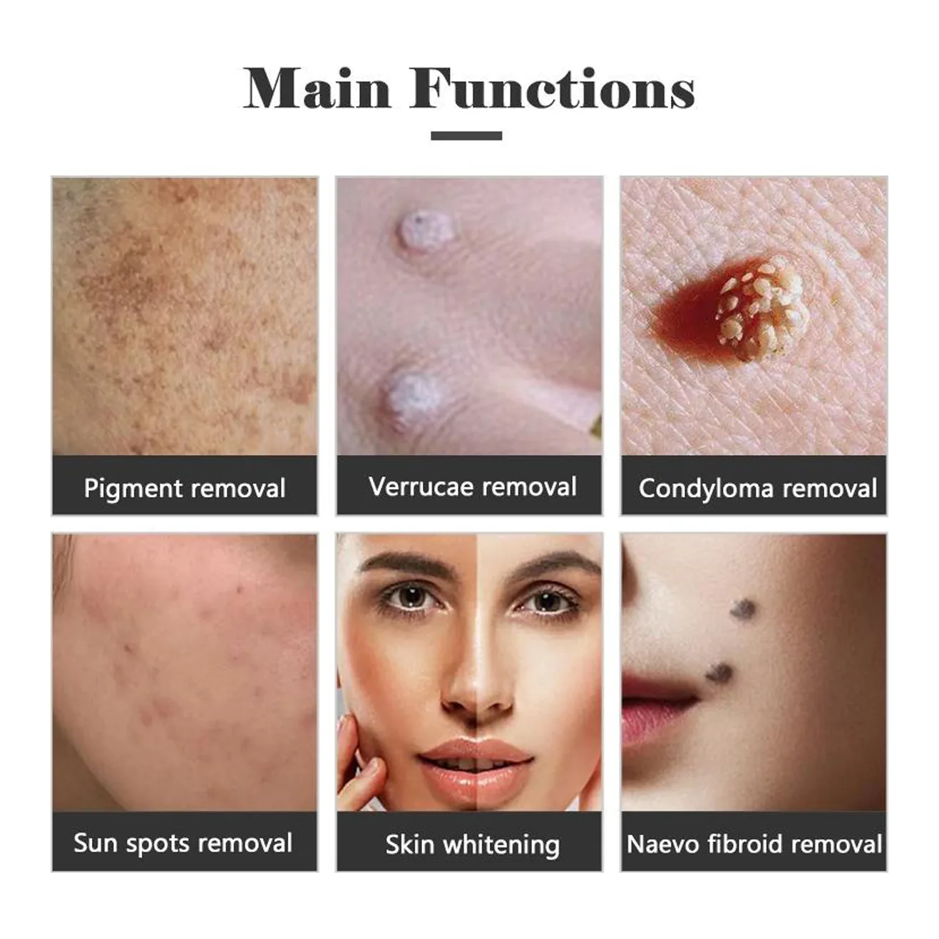 Skin Tag & Blemish Removal Course