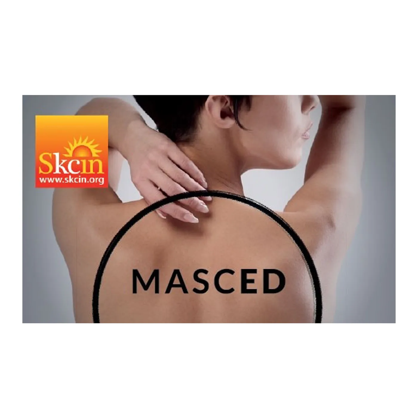 Skin Tag & Blemish Removal Course